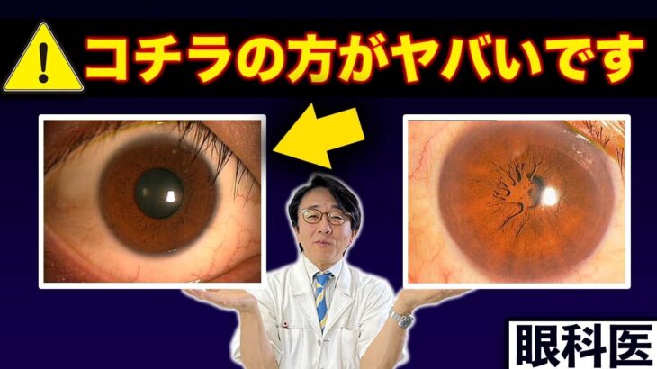 【眼科クイズ】あなたはわかる！？失明する目と大丈夫な目の違い【症例あり】