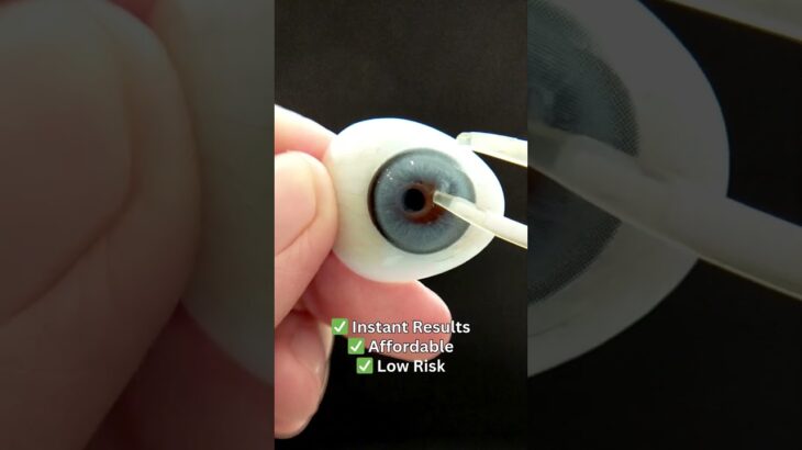 Eye ring implant vs. colored contacts