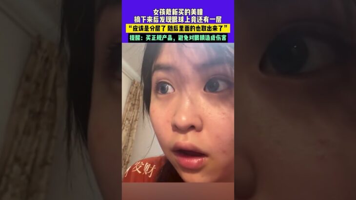 女孩戴新買的美瞳，摘下來後發現眼球上竟還有一層，“應該是分層了隨後裡面的也取出來了”，提醒：買正規產品，避免對眼睛造成傷害