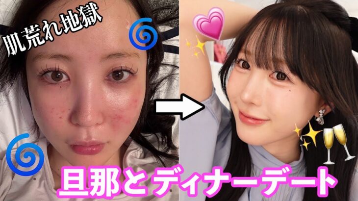 【肌荒れ】旦那と久々ディナーメイク‼妊活むずい…。