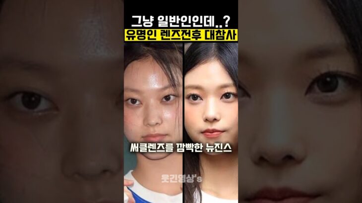 유명인 렌즈전후 레전드 대참사 모음